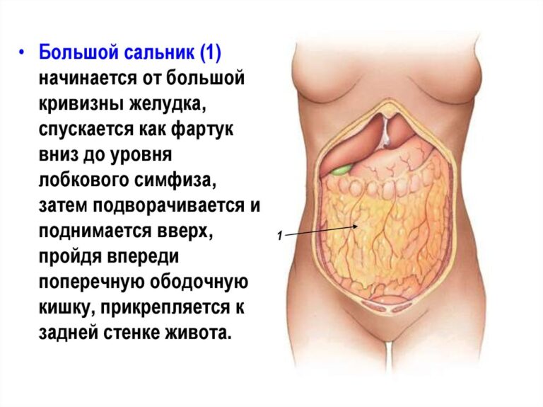 Хирургическое удаление большого сальника и возможные послеоперационные осложнения